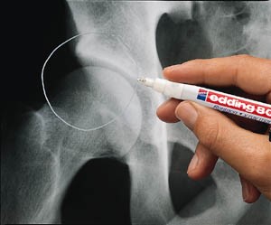 Rentgen marker E-8010 0,8mm Rentgen marker E-8010 0,8mm